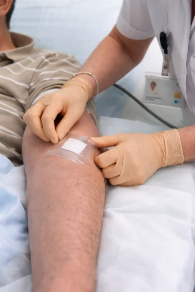 produits 2 neo fistula